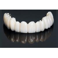 China Accuracy Dental Implant Crown Restorations Professional FDA Certified factory