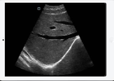 Transvaginal Ultrasound Probe Wireless Ultrasound Probe Convex Linear Cardiac Probe Detachable