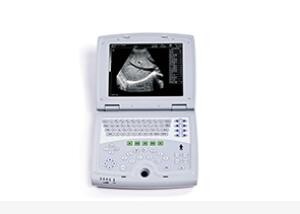 Quality Mobile Ultrasound Machine Digital Laptop Ultrasound Scanner with 100 Frames Permanent Storage for sale