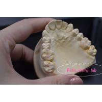 China Effective E.Max / Composite Inlays And Onlays For Repair Damaged Or Decayed Teeth factory