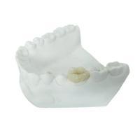 Quality Durable FDA All-Ceramic Dental Crown Veneer Inlay Onlay Similar for sale