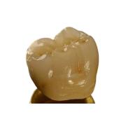 Quality Inter Miscibility Porcelain Dental Crown for sale