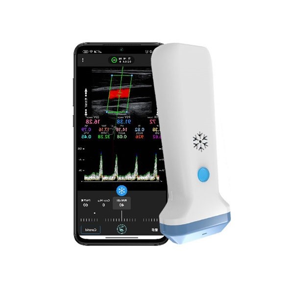 Quality 12.6cm Portable Color Doppler Ultrasound Scanner For Healthcare Professionals for sale