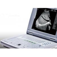 China Portable Ultrasound Machine for Pregnancy Portable Ultrasound Scanner Only 2.2kgs Weight factory