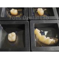 China Dental Restorations Zirconia Multilayer Fracture Resistance factory