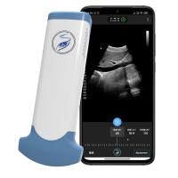 Quality CE Marked 3.6MHz Portable Wifi Ultrasound Scanners JPEG BMP PNG MPEG-4 for sale