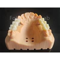 China Customized Full Contour Zirconia Layered With Porcelain Dental Material factory