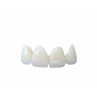 Quality Easy Cleaning All Ceramic Crowns Transparent Natural Shade Customizable for sale