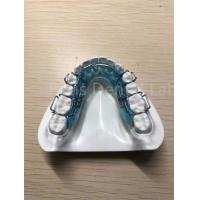China Adjustable Retainer Palate Expander Safe Comfortable Teeth Retention Solution factory