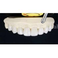 China 0.3-0.5mm Ceramic Laminate Teeth False Teeth Veneers With Adhesive Bonding Cement factory