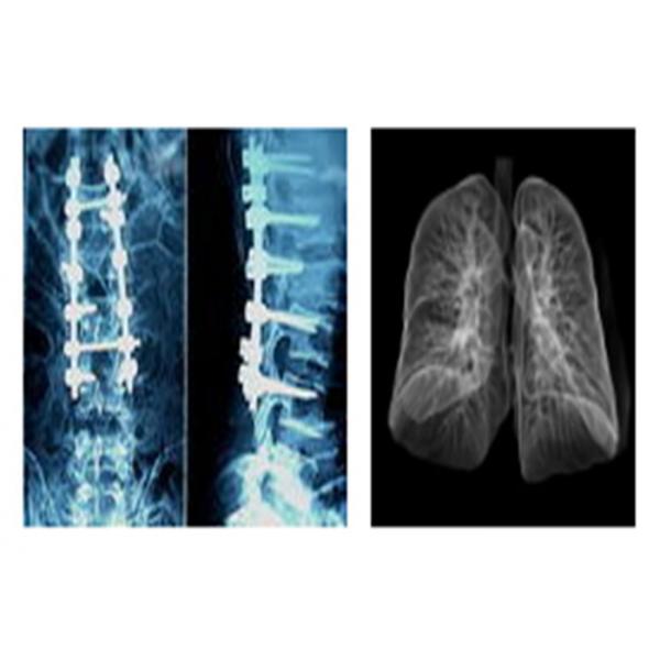 Quality Sharp Radiographic Medical X Ray Films , Mri Dr Ct Digital Dry Imaging Film for sale