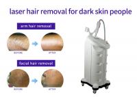 China All Skin Types Thread Vein Removal Machine , Vertical Style Laser Acne Removal Machine factory
