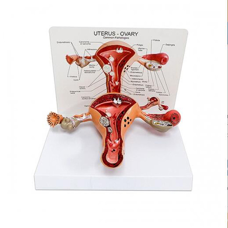 China Medical Human Female Pathology Uterus Anatomy Model For Doctors / Students Display factory