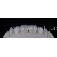 China Smooth Polished Ceramic Laminate Veneers In Dentistry Smile Creators factory