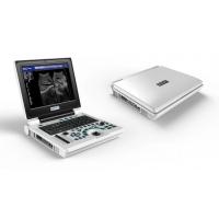 Quality Hospital Laptop Portable USG Machine Portable Ultrasound Machines USS Scanner for sale