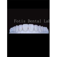 China High Translucency Porcelain Tooth Veneers Enhance Your Smile Naturally factory