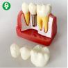 China Anatomical Patient Education Models Dental / Teeth Demonstration Model factory