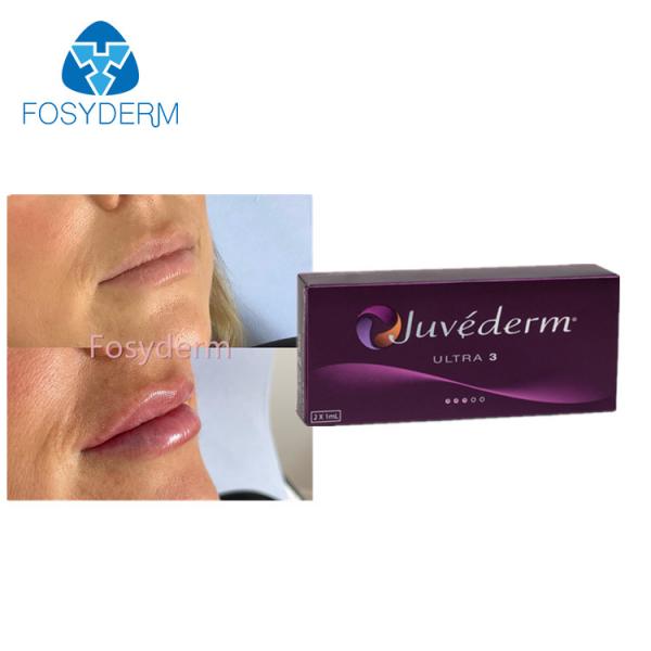 Quality Juvederm Ultra3 Lip Enhancement Hyaluronic Acid Dermal Filler 2x1.0ml for sale