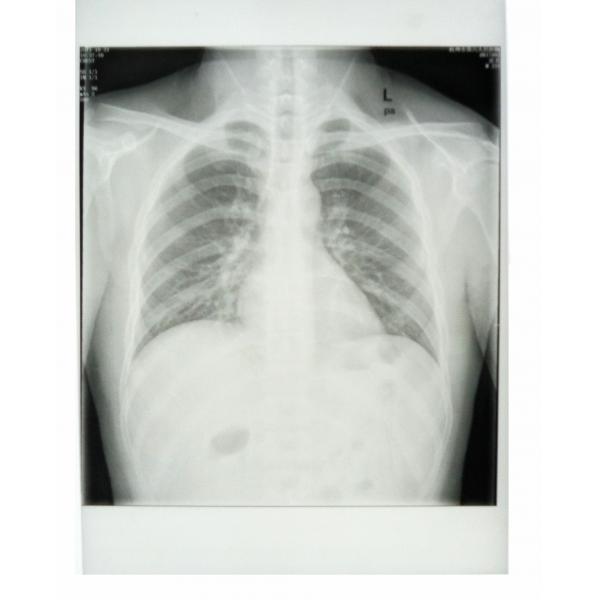 Quality Custom 25cm * 30cm White Base Xray Paper Medical Film with PET materials for sale