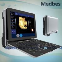 China 4D Realtime Musculoskeletal Ultrasound Systems fetak doppler ultrasound Ultrasound Diagnosis System factory