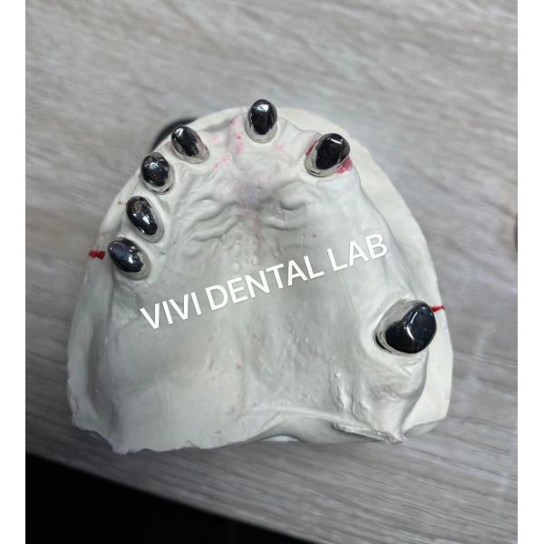 Quality Ni Be Free Dental Lab Crowns Telescopic Secondary Primary Teeth Crowns for sale