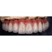 China Staining Resistance  Dental Lab Crowns For Various Tooth Replacements factory