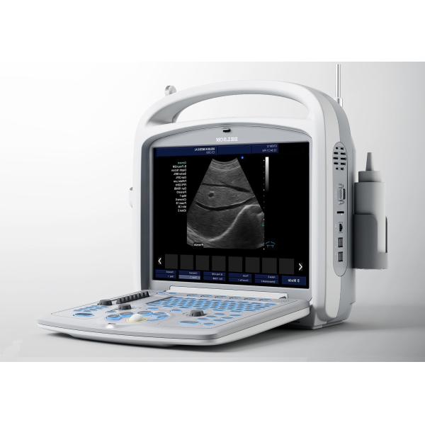 Quality Medical Ultrasound Machine Portable Ultrasound Scanner 4d Ultrasound Equipment for sale