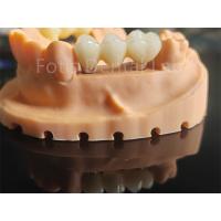 China High Toughness Zirconia Based Ceramics Material For Dental Applications factory