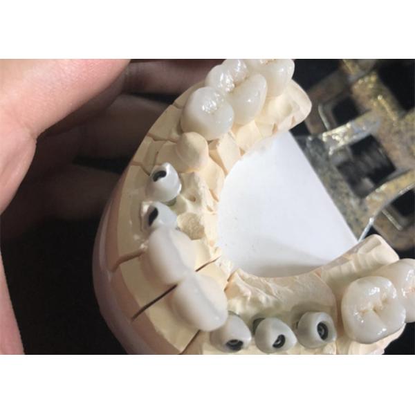 Quality Metal Free White Zirconia Dental Crowns Excellent Biocompatibility for sale