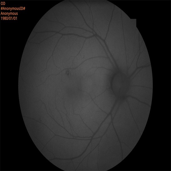 Quality FAF Non Mydriatic Fundus Camera Optical Retinal Imaging for sale