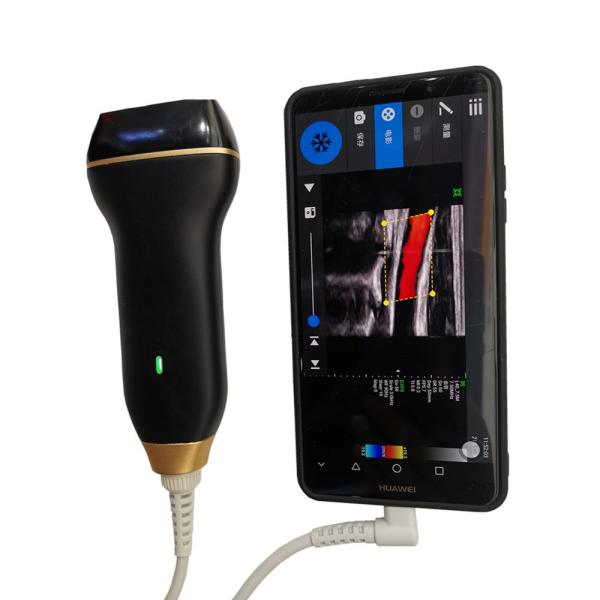 Quality Diagnostic Handheld Ultrasound Scanner Equipment Wireless With 8 TGC Adjustments for sale