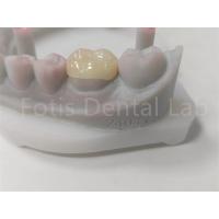 China OEM Dental Inlay And Onlay Ceramic Restoration And Tooth-Colored Filling factory