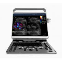 Quality Portable Cardiac Ultrasound Machine Chison EBit 50 16.5lbs for sale