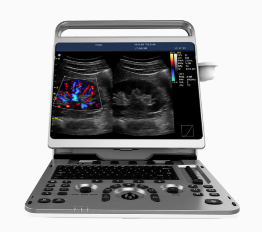 Quality Portable Cardiac Ultrasound Machine Chison EBit 50 16.5lbs for sale
