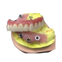Quality Zirconia Dental Crown for sale