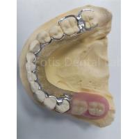 China Replace Missing Teeth Removable Partial Denture Dental Prosthesis Flexible Design factory