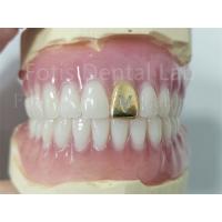 China Comfortable Precision Fit Full Acrylic Denture Prosthesis With Natural Teeth factory