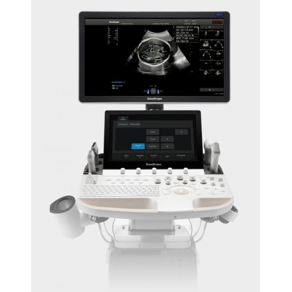 Quality Artificial Intelligence Based SonoScape Ultrasound Machine Trolley P60 Exp for sale