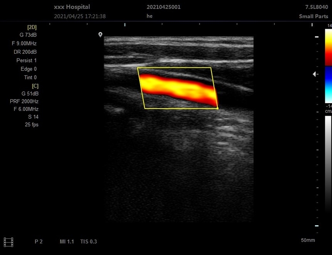 OEM Portable 3D Veterinary Ultrasound Machine For Clinical Hospitable 5