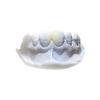 Quality Efficient Resin Removable PFM Dental Crown Health Materials for sale