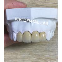 Quality Dental Lab Metal Ceramic Crown PFM Crown High esthetics Perfect fit for sale