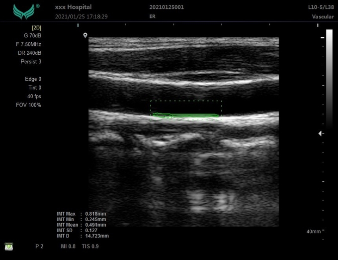 OEM Portable 3D Veterinary Ultrasound Machine For Clinical Hospitable 6