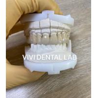 China Precise Dental Lab Crowns Esthetic Porcelain Zirconia Tooth Crown factory