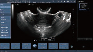 Quality Transvaginal Probe Mobile Color Doppler Ultrasound Scanner For Pregnancy for sale