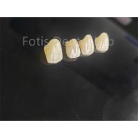 China Professional Grade Porcelain Fused Zirconia For Perfectly Fitting Dental Restorations factory