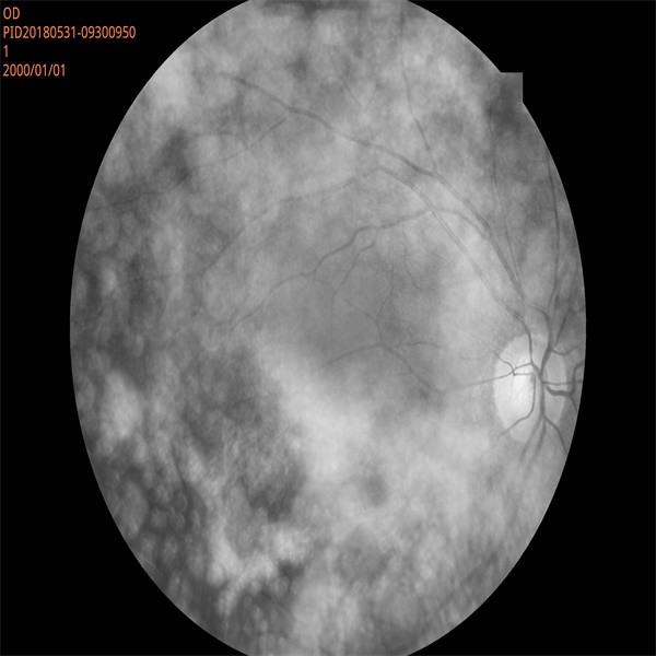 Quality 2.8mm Wide Field Fundus Camera Retinal Imaging Equipment for sale