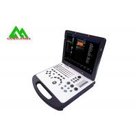 China High Accuracy Laptop Ultrasound Scan Machine With Lithium Battery For Human Use factory
