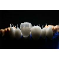 China Long-Lasting and Durable Prosthetic Laminate Veneers with Porcelain Material factory