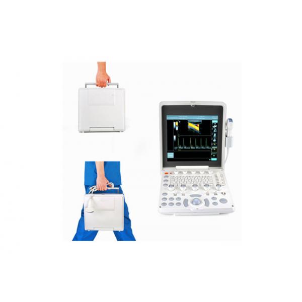 Quality Portable Color Doppler Ultrasound Scanner With 12.1 Inch Screen 2.5-10 MHz Multi-Frequency Probe for sale
