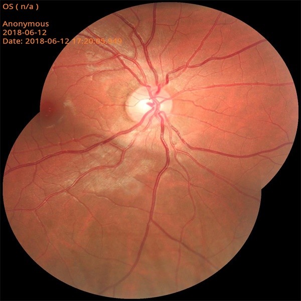 Quality Mini Fundus Photography Equipment Near Infrared Light Imaging Technology for sale